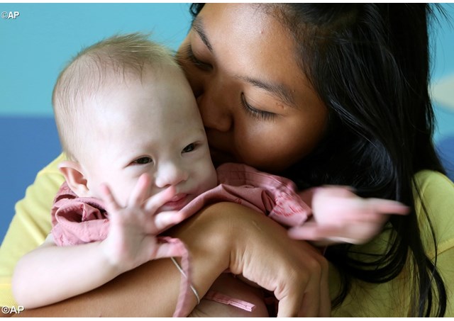 Svjetski dan osoba s Downovim sindromom - 